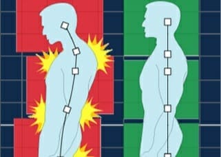 NYTimes: Lower Back Ache? Be Active and Wait It Out, New Guidelines Say